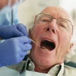 Despre implanturile pterigoidiene: indicații, tehnică și posibile complicații